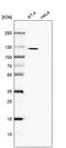 TBC1 Domain Family Member 2B antibody, PA5-62662, Invitrogen Antibodies, Western Blot image 