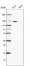 TBC1 Domain Family Member 2B antibody, PA5-62662, Invitrogen Antibodies, Western Blot image 