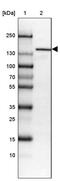Hypoxia Up-Regulated 1 antibody, PA5-61925, Invitrogen Antibodies, Western Blot image 