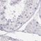 Ornithine Carbamoyltransferase antibody, PA5-51416, Invitrogen Antibodies, Immunohistochemistry frozen image 