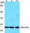 Tumor necrosis factor alpha-induced protein 8 antibody, A05158-1, Boster Biological Technology, Western Blot image 