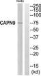 Calpain 9 antibody, TA312323, Origene, Western Blot image 