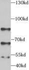 Serine/Threonine Kinase 3 antibody, FNab08329, FineTest, Western Blot image 