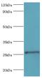 Tissue Factor Pathway Inhibitor 2 antibody, MBS1499036, MyBioSource, Western Blot image 