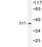 SS18 Subunit Of BAF Chromatin Remodeling Complex antibody, LS-B9154, Lifespan Biosciences, Western Blot image 