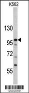 MDM2 Binding Protein antibody, MBS9212096, MyBioSource, Western Blot image 