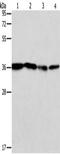 NFKB Inhibitor Alpha antibody, orb518426, Biorbyt, Western Blot image 