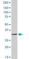 Fructose-Bisphosphatase 2 antibody, H00008789-D01P, Novus Biologicals, Western Blot image 