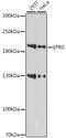 Glutamyl-Prolyl-TRNA Synthetase antibody, orb539369, Biorbyt, Western Blot image 