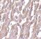 MYD88 Innate Immune Signal Transduction Adaptor antibody, MA5-15762, Invitrogen Antibodies, Immunohistochemistry paraffin image 