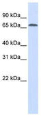 Interferon Regulatory Factor 2 Binding Protein 1 antibody, TA333798, Origene, Western Blot image 