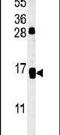 CD69 Molecule antibody, PA5-25328, Invitrogen Antibodies, Western Blot image 