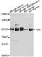 Toll Like Receptor 1 antibody, A0997, ABclonal Technology, Western Blot image 