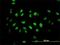 Tousled Like Kinase 2 antibody, H00011011-M01, Novus Biologicals, Immunocytochemistry image 