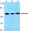 Cytochrome P450 Family 4 Subfamily F Member 2 antibody, A01737-1, Boster Biological Technology, Western Blot image 