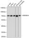 Kringle Containing Transmembrane Protein 1 antibody, GTX64893, GeneTex, Western Blot image 