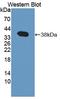 Tensin 3 antibody, LS-C373399, Lifespan Biosciences, Western Blot image 