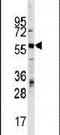 Zinc Finger And BTB Domain Containing 7B antibody, PA5-13382, Invitrogen Antibodies, Western Blot image 