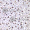 DNA Topoisomerase I antibody, A7741, ABclonal Technology, Immunohistochemistry paraffin image 