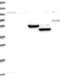 Ankyrin Repeat Domain 12 antibody, NBP1-93990, Novus Biologicals, Western Blot image 