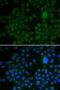 LDL Receptor Related Protein 1 antibody, LS-C748556, Lifespan Biosciences, Immunofluorescence image 