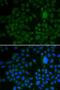 APR antibody, LS-C748556, Lifespan Biosciences, Immunofluorescence image 