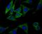 Cytoplasmic Linker Associated Protein 1 antibody, A04813-2, Boster Biological Technology, Immunocytochemistry image 