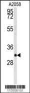 WW Domain Binding Protein 2 antibody, 63-203, ProSci, Western Blot image 