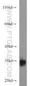 Bone Marrow Stromal Cell Antigen 2 antibody, 13560-1-AP, Proteintech Group, Western Blot image 