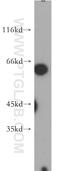 N-Acetylglutamate Synthase antibody, 21566-1-AP, Proteintech Group, Western Blot image 
