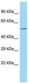 Karyopherin Subunit Alpha 7 antibody, TA334317, Origene, Western Blot image 