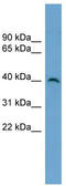 Histone-lysine N-methyltransferase SUV39H2 antibody, TA346829, Origene, Western Blot image 