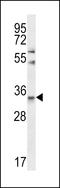 Chymotrypsin Like Elastase 3A antibody, LS-C168660, Lifespan Biosciences, Western Blot image 