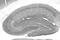 Distal-Less Homeobox 1 antibody, 75-078, Antibodies Incorporated, Immunohistochemistry paraffin image 