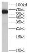 Suppression Of Tumorigenicity 7 Like antibody, FNab08274, FineTest, Western Blot image 