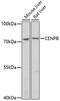 Centromere Protein B antibody, A05140, Boster Biological Technology, Western Blot image 