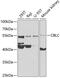 Cbl Proto-Oncogene C antibody, GTX33067, GeneTex, Western Blot image 