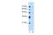 Ankyrin Repeat Domain 65 antibody, PA5-43105, Invitrogen Antibodies, Western Blot image 