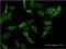 Major Histocompatibility Complex, Class I-Related antibody, H00003140-M04, Novus Biologicals, Immunofluorescence image 