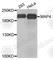 Microtubule Associated Protein 4 antibody, A5906, ABclonal Technology, Western Blot image 