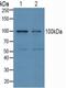 Ubiquitin Protein Ligase E3A antibody, MBS2027241, MyBioSource, Western Blot image 