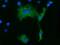 Kelch Like Family Member 2 antibody, MA5-25206, Invitrogen Antibodies, Immunocytochemistry image 
