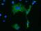 Kelch Like Family Member 2 antibody, MA5-25206, Invitrogen Antibodies, Immunocytochemistry image 