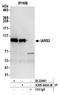 Isoleucyl-tRNA synthetase, mitochondrial antibody, A305-640A-M, Bethyl Labs, Immunoprecipitation image 