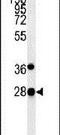 Prolyl Endopeptidase Like antibody, PA5-25478, Invitrogen Antibodies, Western Blot image 