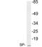 Trefoil Factor 2 antibody, LS-C200011, Lifespan Biosciences, Western Blot image 