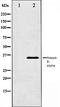 Insulin Receptor antibody, orb99411, Biorbyt, Western Blot image 