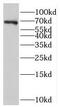 Nucleolar Protein 4 antibody, FNab05785, FineTest, Western Blot image 