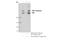 Von Willebrand Factor antibody, 65707T, Cell Signaling Technology, Immunoprecipitation image 