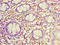 Syndecan 1 antibody, A56799-100, Epigentek, Immunohistochemistry paraffin image 